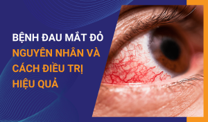 Bệnh đau mắt đỏ Nguyên nhân và cách điều trị hiệu quả