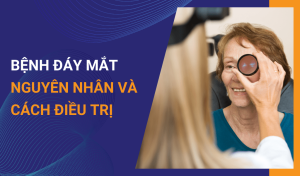 Bệnh đáy mắt là gì Nguyên nhân và cách điều trị