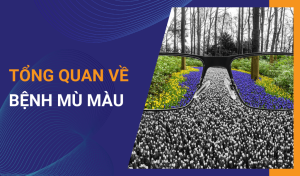 Bệnh mù màu là gì _ Nguyên nhân gây ra bệnh mù màu và cách điều trị