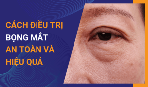 Bọng mắt là gì Cách điều trị bọng mắt an toàn và hiệu quả