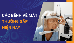 Các bệnh về mắt thường gặp trong cuộc sống
