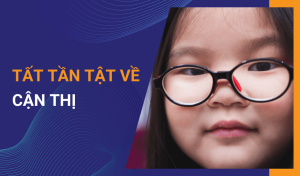 Cận thị nguyên nhân, triệu chứng và cách điều trị