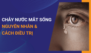 Chảy nước mắt sống là bệnh gì Cách khắc phục từ chuyên gia