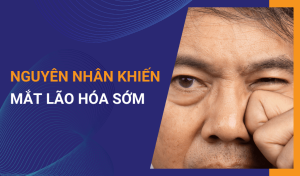 Lão hóa mắt là gì Cách phòng tránh mắt bị lão hóa sớm