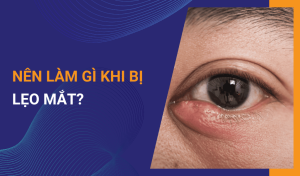 Lẹo mắt là gì Nguyên nhân và cách điều trị khi mắt bị lẹo