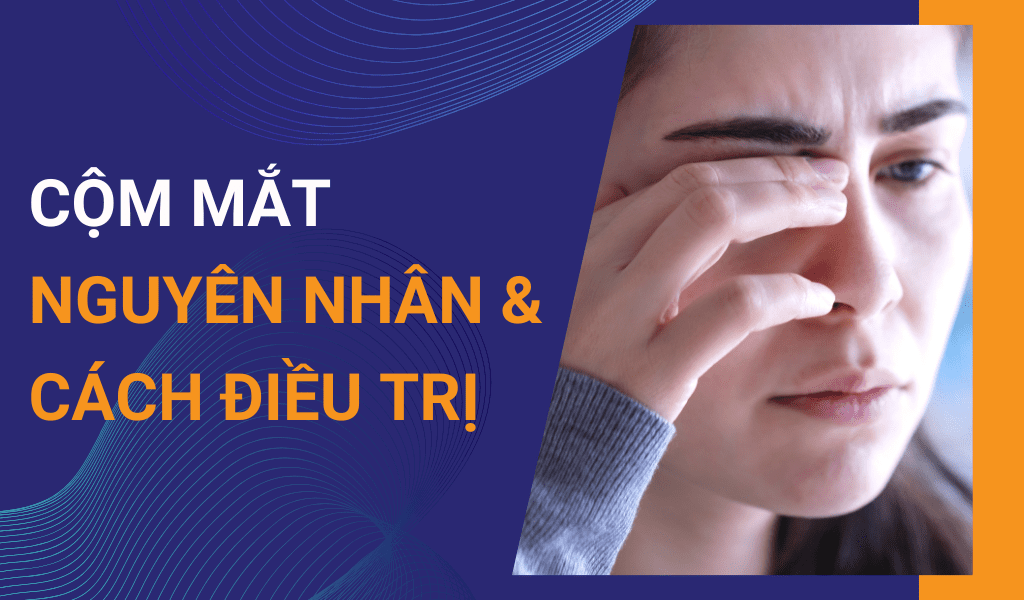 Mắt Bị Cộm Nguyên Nhân Và Cách điều Trị Hiệu Quả 