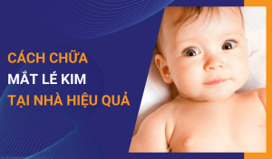 Mắt lé kim là gì Cách chữa lé kim tại nhà hiệu quả