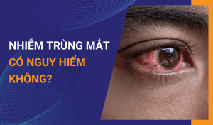 Nên làm gì khi bị nhiễm trùng mắt
