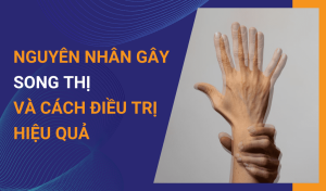 Nguyên nhân gây song thị và cách điều trị hiệu quả