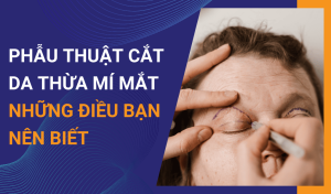 Những điều bạn nên biết về phẫu thuật cắt da thừa mí mắt