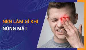 Nóng mắt là dấu hiệu của bệnh gì Nên làm gì khi mắt bị nóng