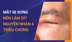 Sưng mắt - nguyên nhân, triệu chứng và cách giảm sưng