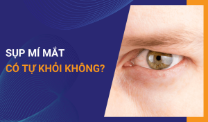 Sụp mí mắt có tự khỏi không
