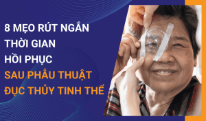 Top 8 mẹo giúp bạn chăm sóc mắt sau mổ đục thủy tinh thể hiệu quả