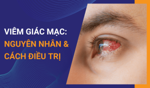 Viêm giác mạc là gì Nguyên nhân và cách điều trị
