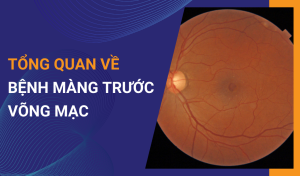 bệnh màng trước võng mạc