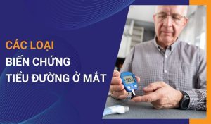 biến chứng tiểu đường ở mắt