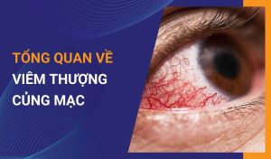 Dấu hiệu nhận biết viêm thượng củng mạc và cách điều trị