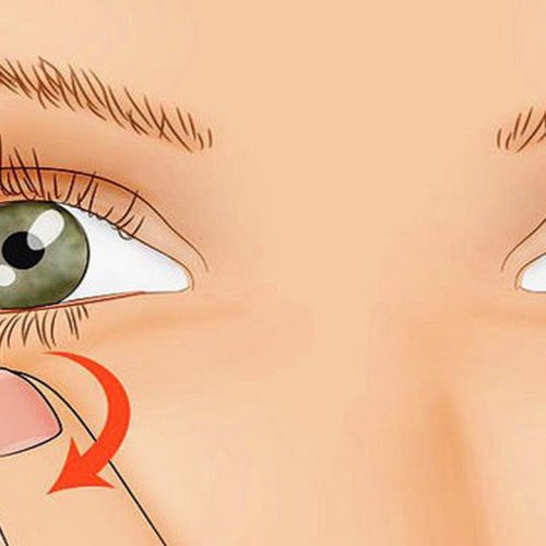 Giật mí mắt diễn ra thế nào ? Có phải dấu hiệu hay triệu chứng bệnh về mắt ?
