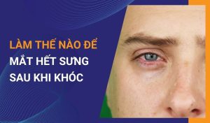 làm thế nào để mắt hết sưng sau khi khóc