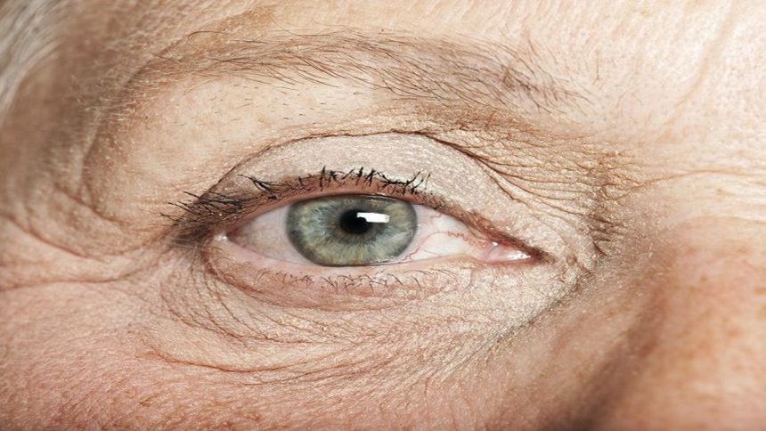 Lão hóa mắt là gì ? Nguyên nhân và cách phòng tránh sớm
