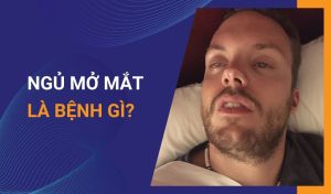 Ngủ mở mắt là bệnh gì
